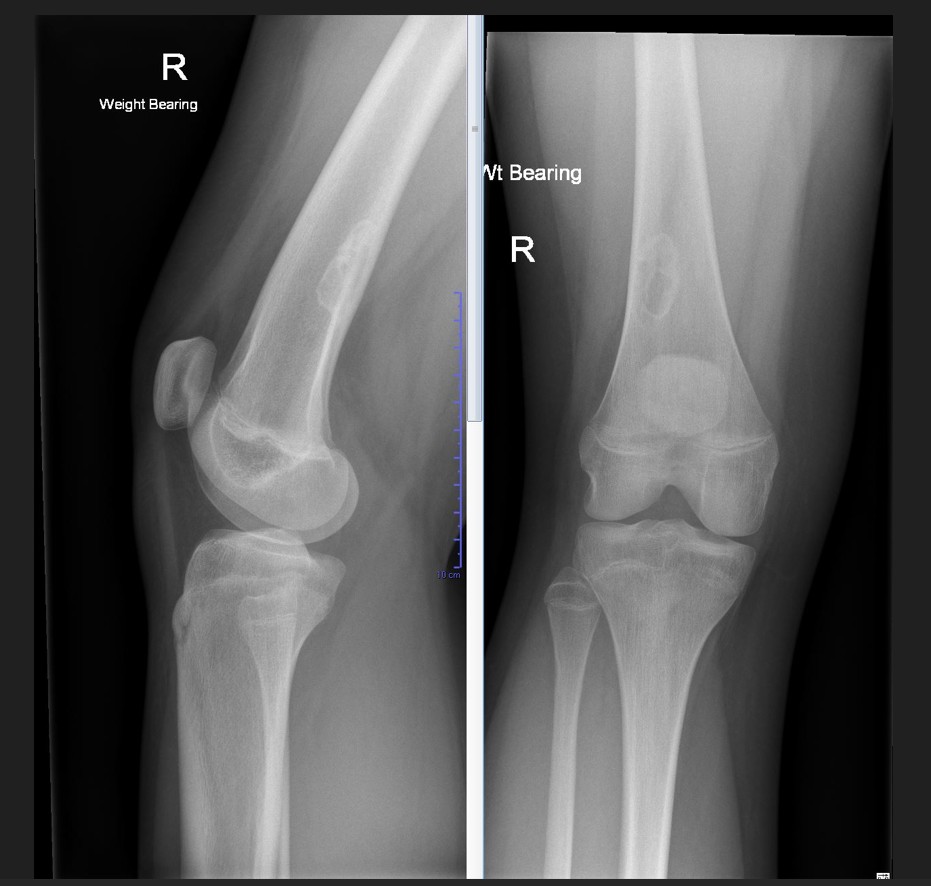 Case 22